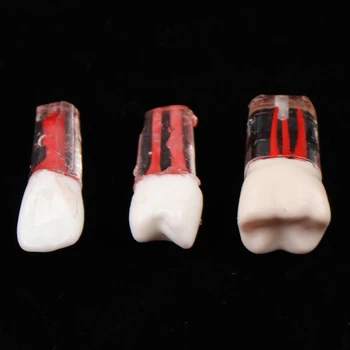 1 Vnt Derva, Dantų Endodontinis Danties Modelis Su Spalvotais Šaknų Kanalų Ir Celiuliozės Praktika
