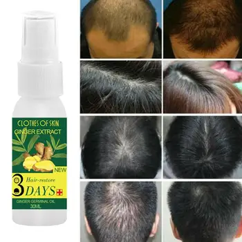 30ml Plaukų Slinkimas Gydymo Imbieras Plaukų Priežiūros Augimo Esmė Naftos moterų, Vyrų Plaukų Slinkimas Produktų, Natūralių, be Jokių pašalinių Efektų Augti