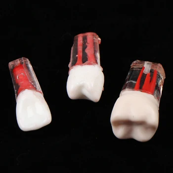 1 Vnt Derva, Dantų Endodontinis Danties Modelis Su Spalvotais Šaknų Kanalų Ir Celiuliozės Praktika